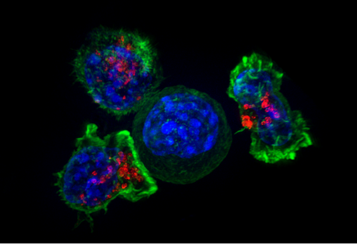 Killer T cells surround a cancer cell