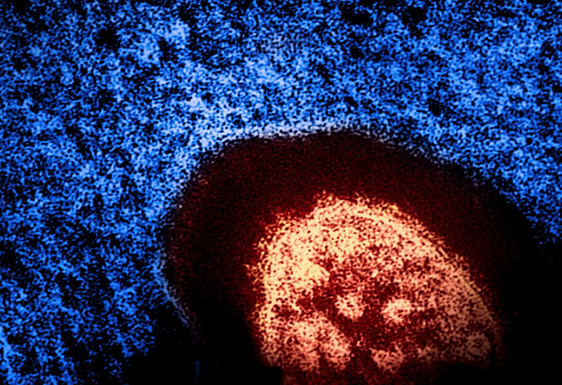 Measles virus