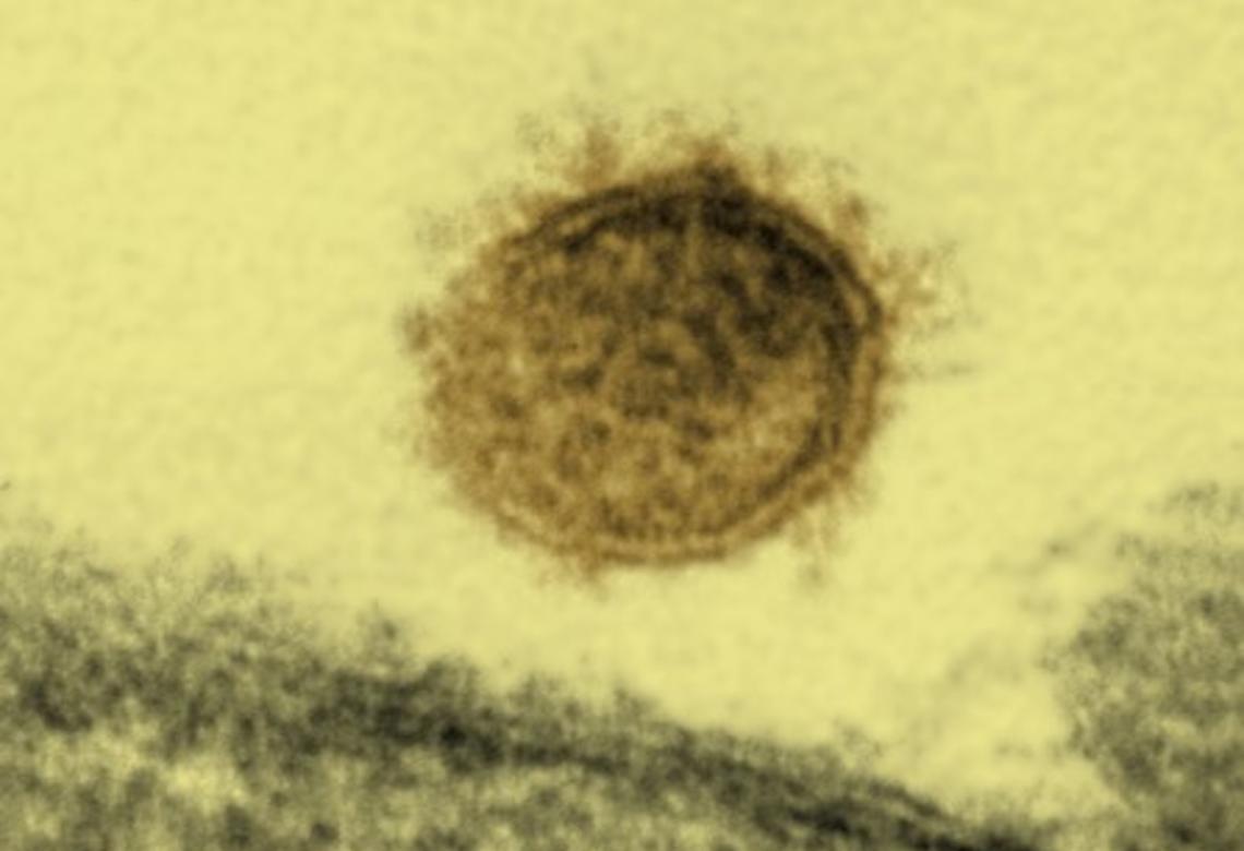 Hantavirus